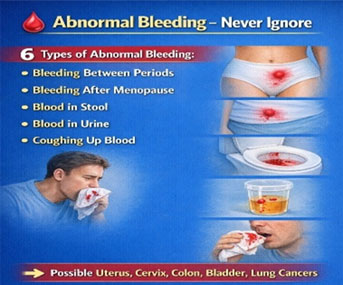 प्रोस्टेट कर्करोग